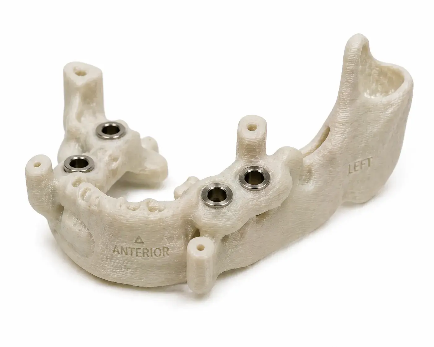 Dispositivo dental impreso en resina biocompatible 3D